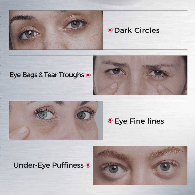 Eye Patches for Dark Circles – - Sheet Mask Collagen review and price