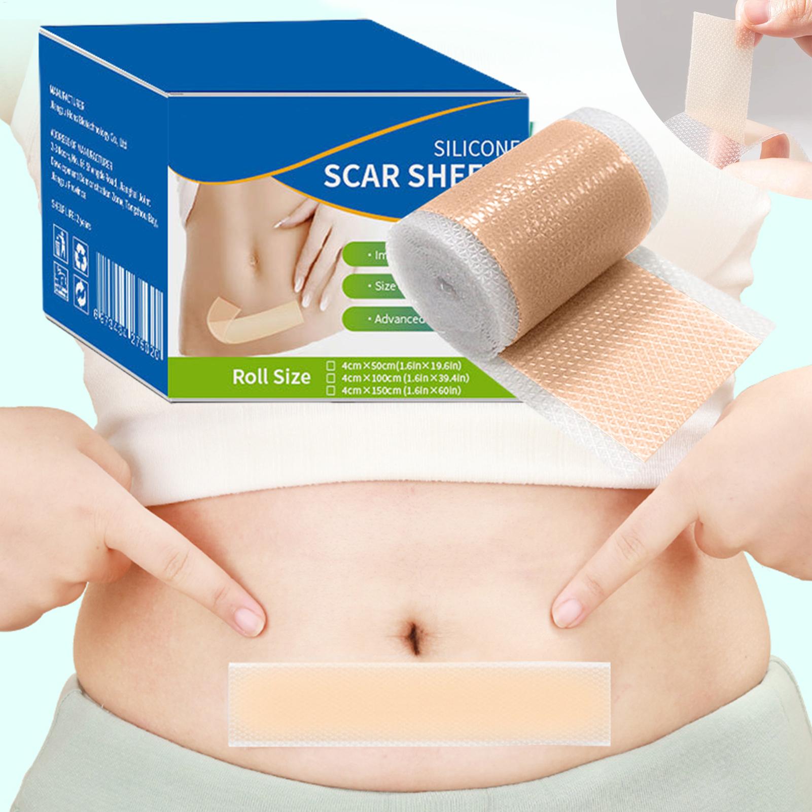 1 Roll Silicone Scar Sheets 4c - Sheet Mask Collagen review and price